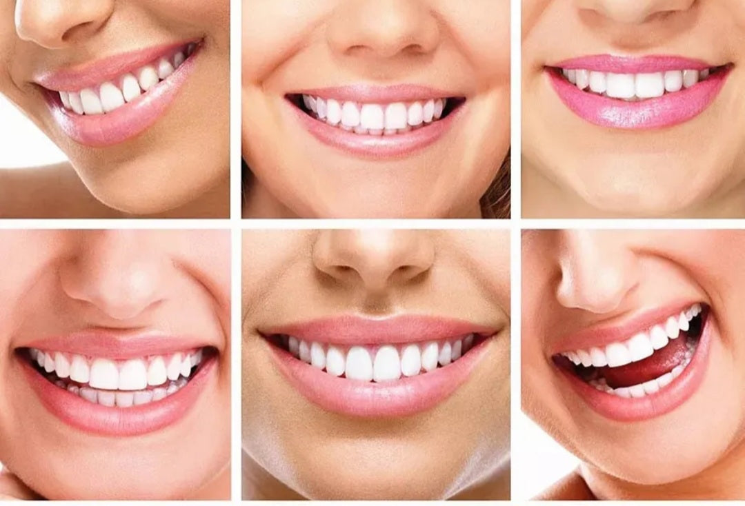 Kit de Blanchiment des Dents Bokkstore - Souriez avec Confiance